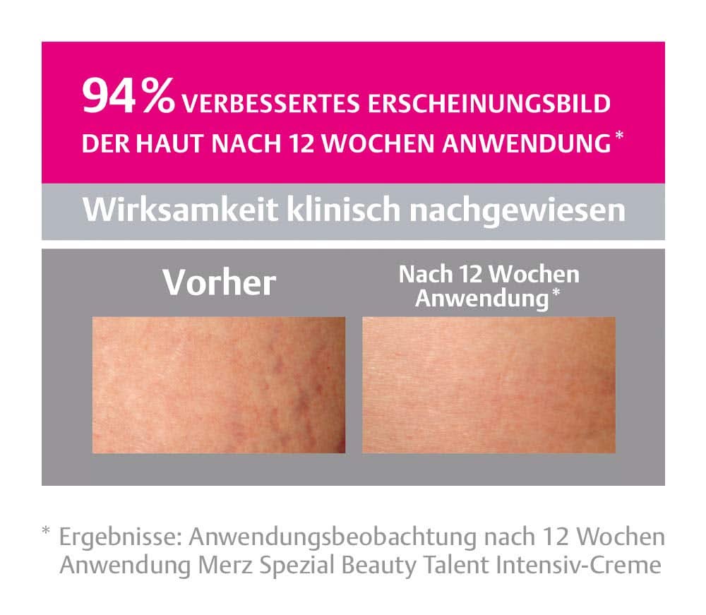 Merz Spezial, Crema intensiva pentru vergeturi, 75 ml Cosmetice si Infrumusetare Naty Shop